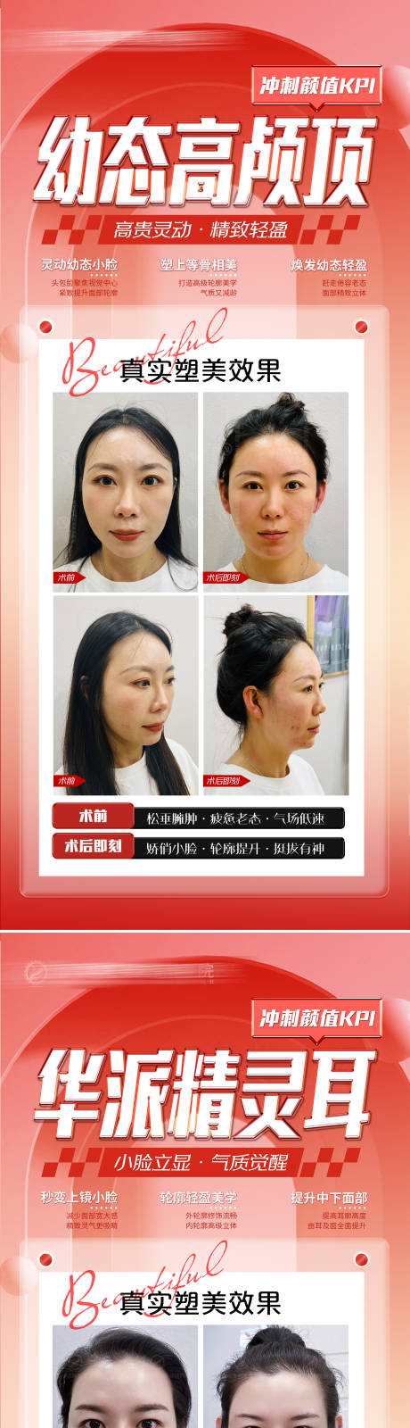 源文件下载【医美高颅顶海报展架】编号：27250015754695122
