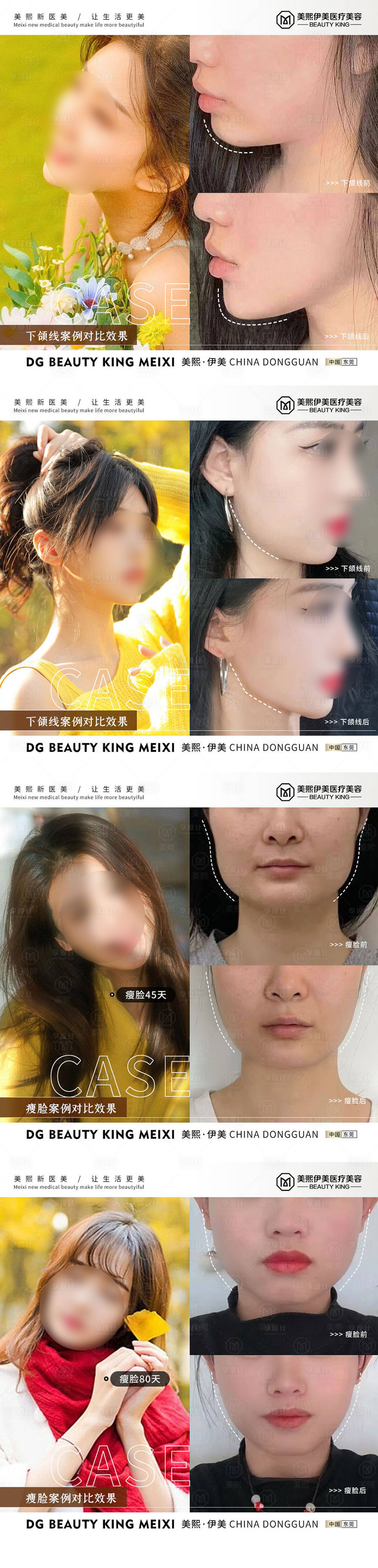 源文件下载【享设计】搜索编号：43730015338978193【瘦脸案例系列海报】