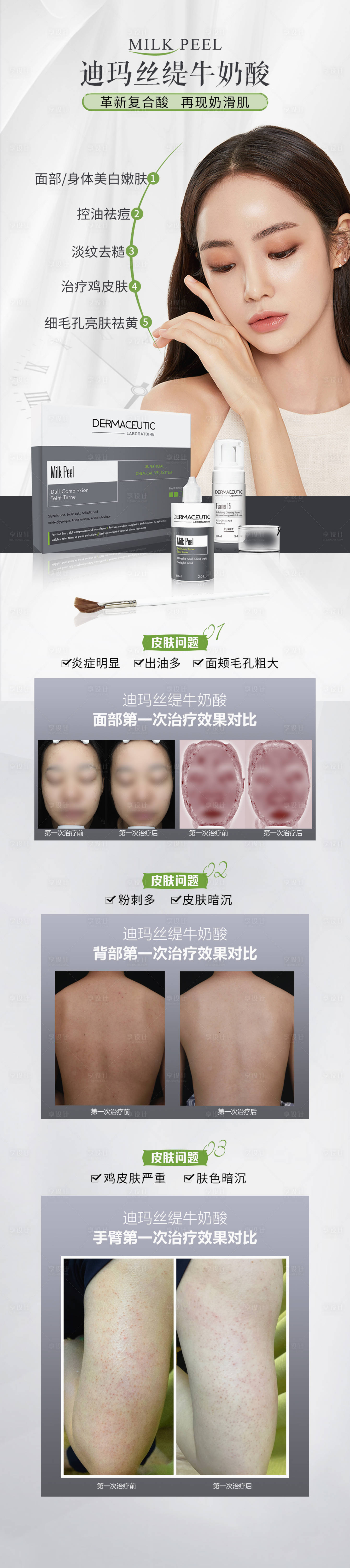 源文件下载【医美牛奶酸项目案例海报长图】编号：74410015678229219