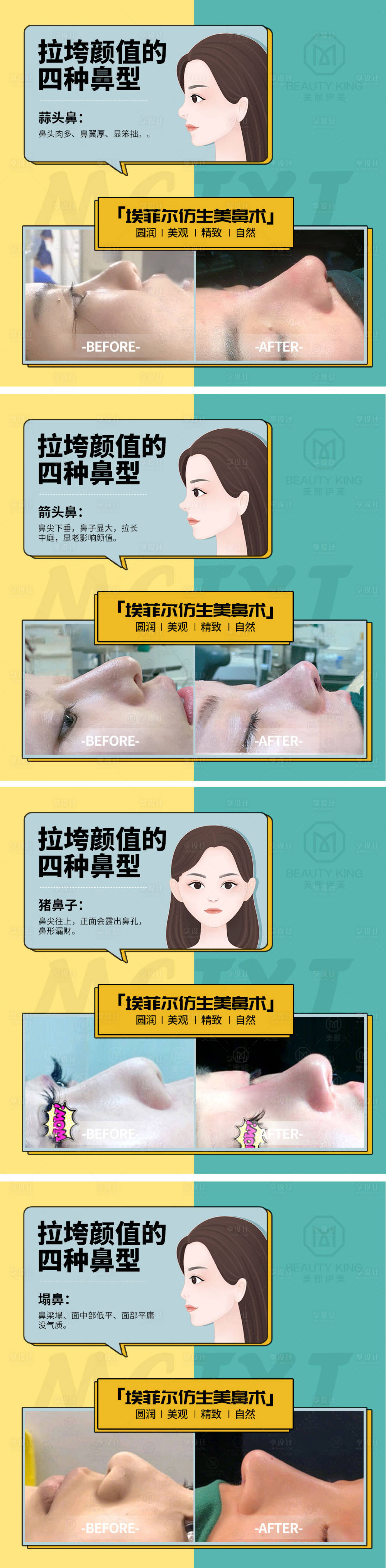 源文件下载【隆鼻助推海报】编号：57790015493636337