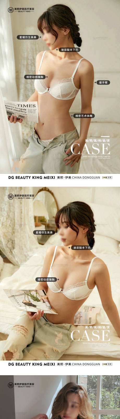 源文件下载【享设计】搜索编号：77670015372494143【医美案例】