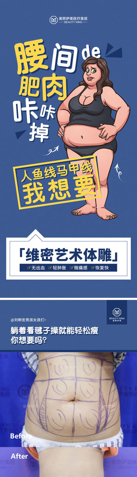 源文件下载【医美体雕海报】编号：29180015713003531
