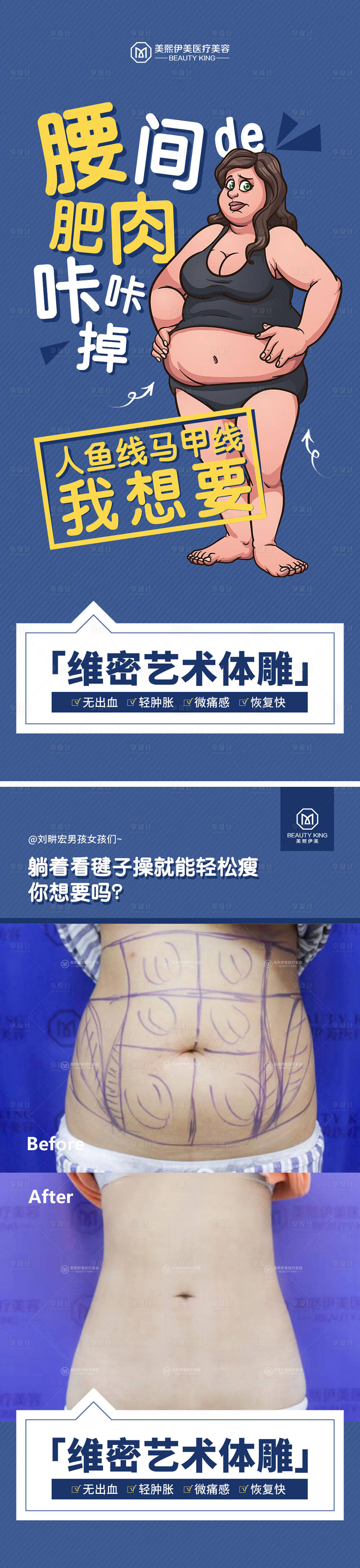 源文件下载【享设计】搜索编号：29180015713003531【医美体雕海报】