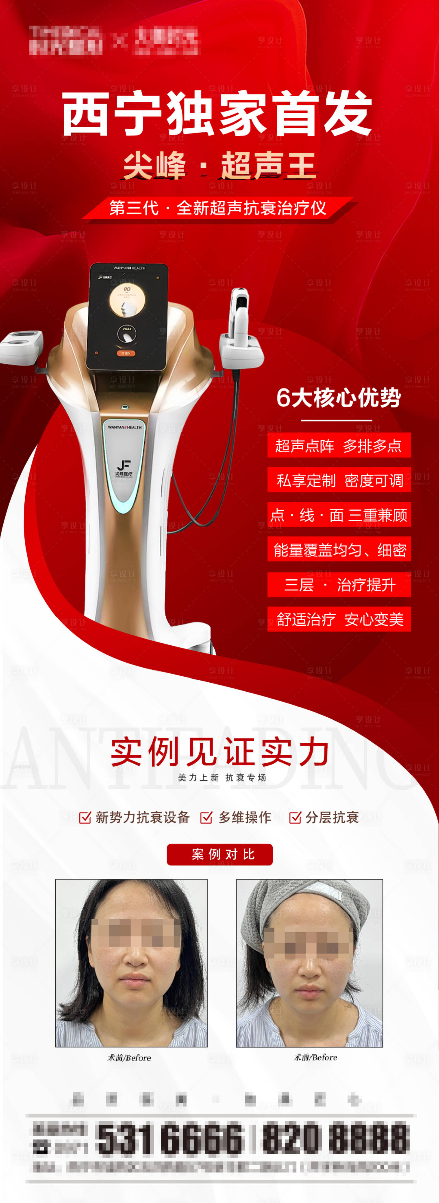 源文件下載【享設計】搜索編號：59570015699597638【尖峰超聲王】
