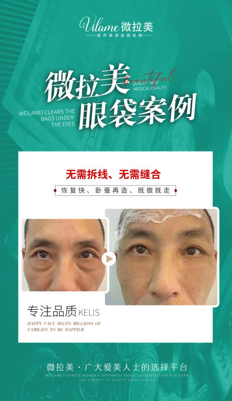 源文件下载【享设计】搜索编号：68510015666683072【医美案例对比图海报 】