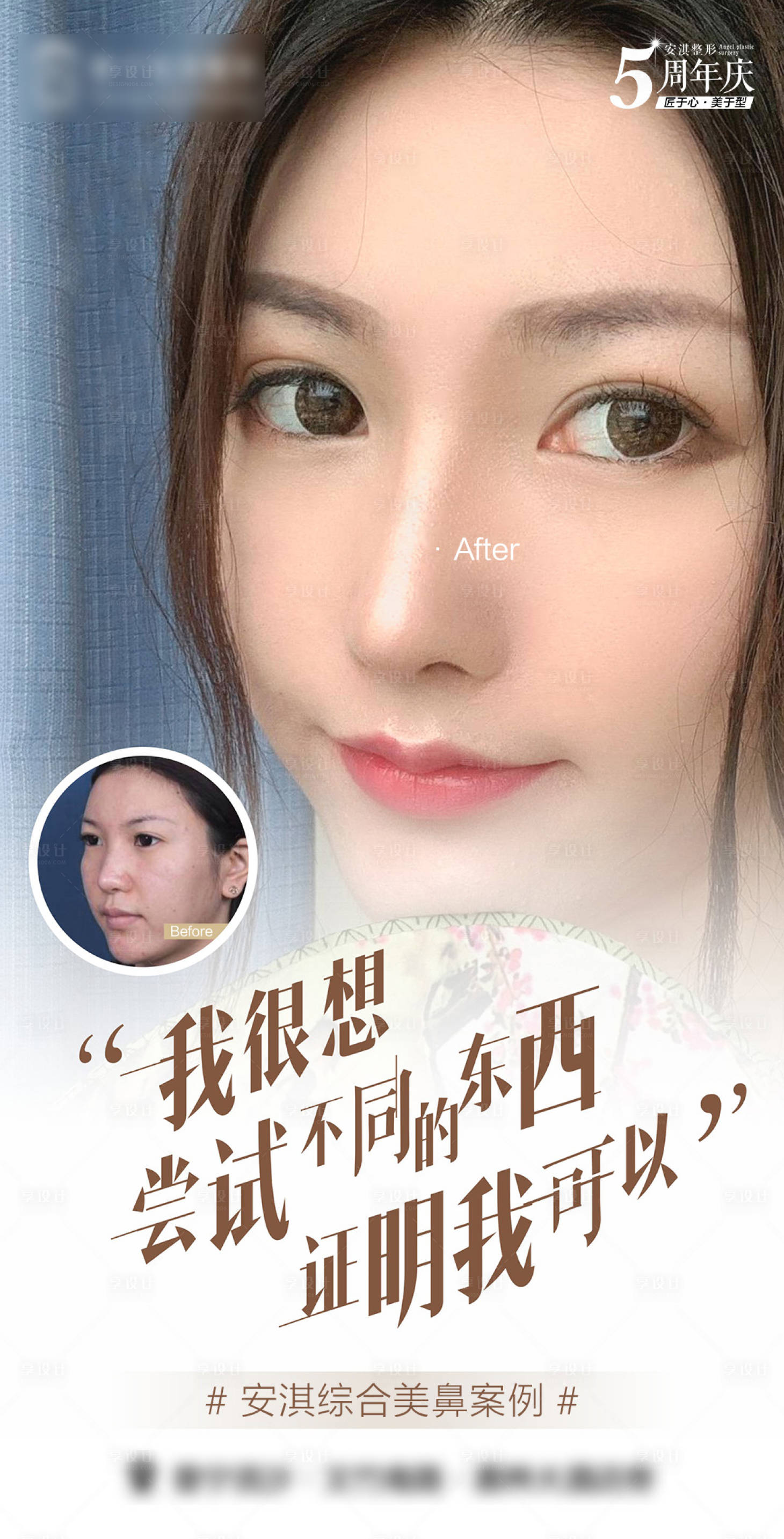 源文件下載【享設計】搜索編號：57190015360588623【醫美隆鼻】