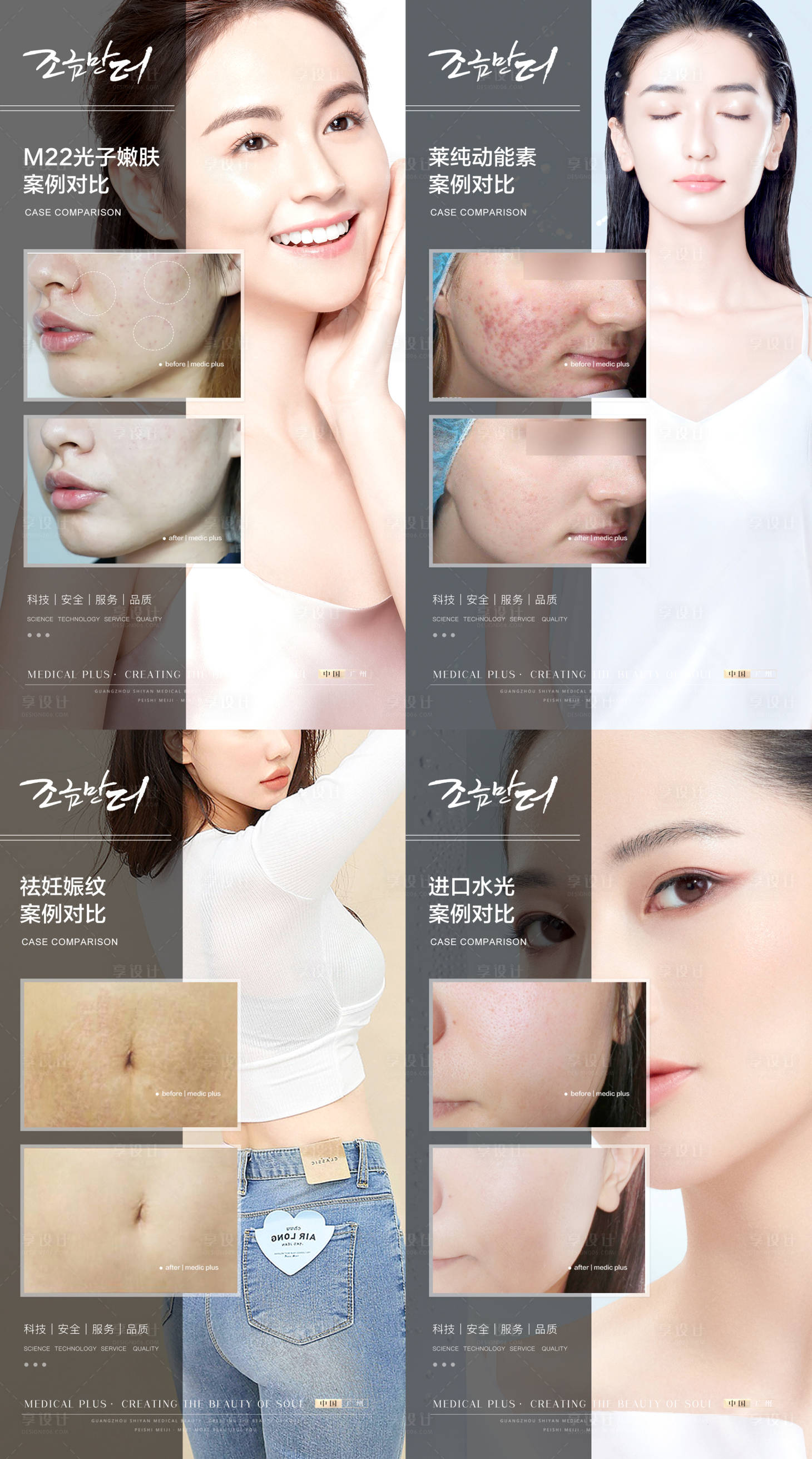 源文件下载【享设计】搜索编号：95350015131829920【医美美容皮肤案例对比系列海报】