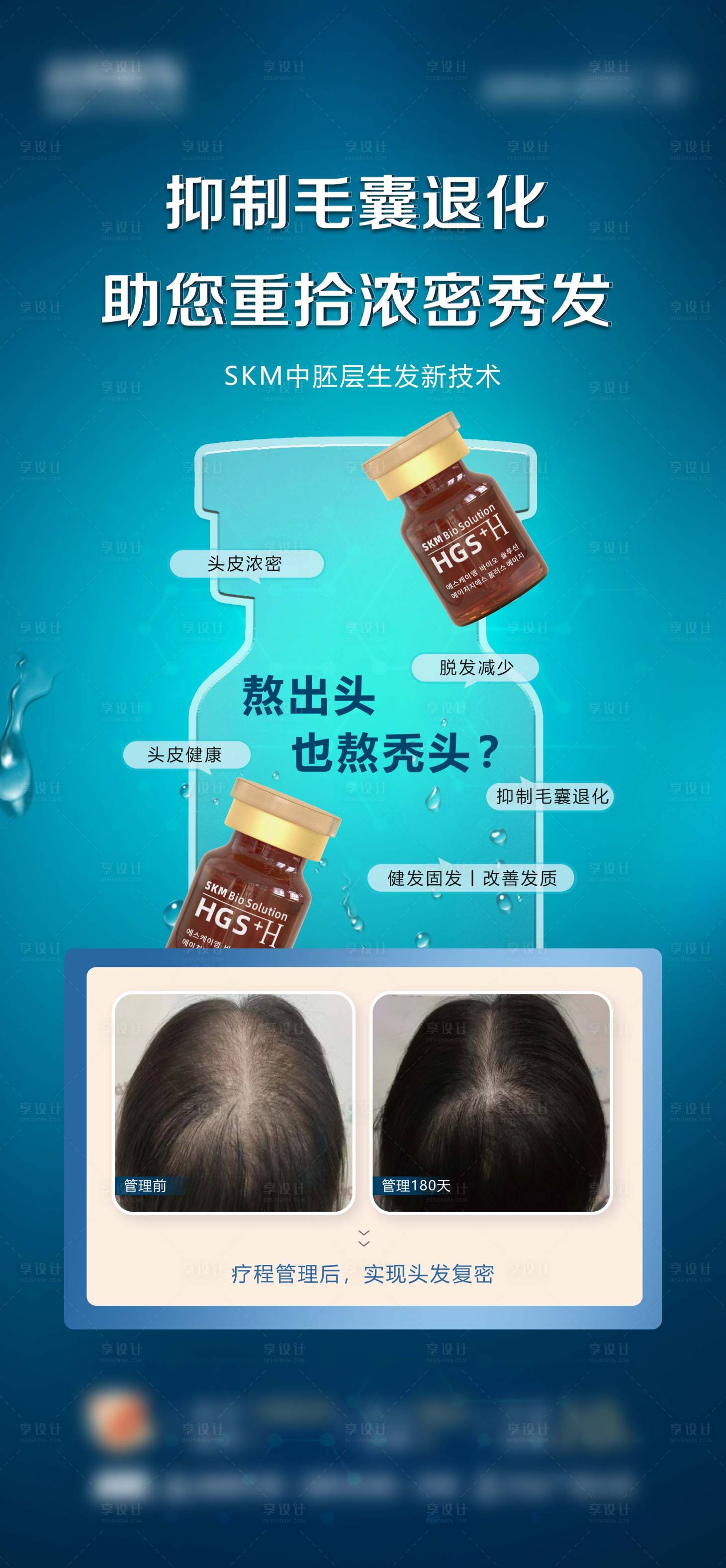 源文件下载【植发 丝科慕】编号：33820015614854976
