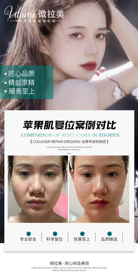 源文件下载【享设计】搜索编号：42860015648943244【医美案例对比】