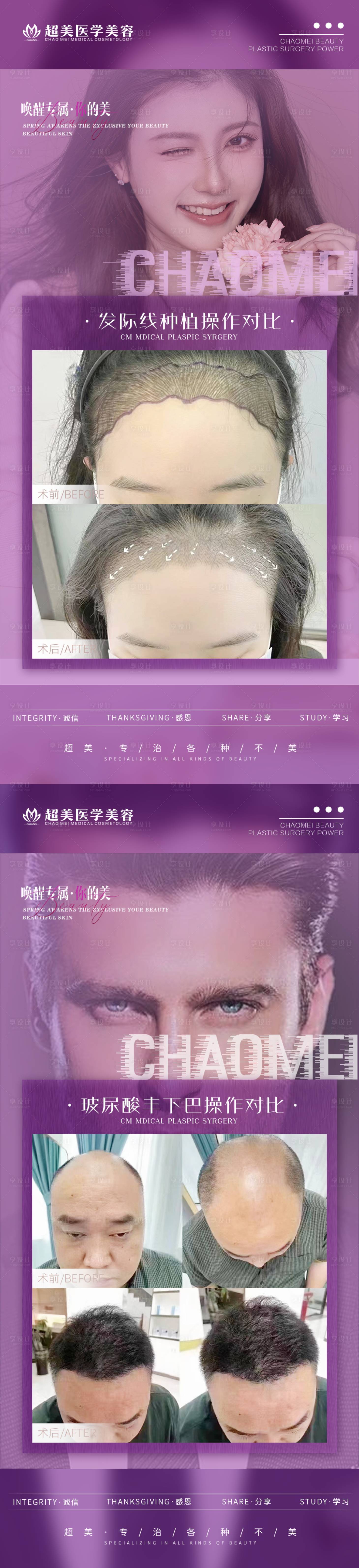 源文件下载【享设计】搜索编号：61470015683624972【植发案例对比系列】