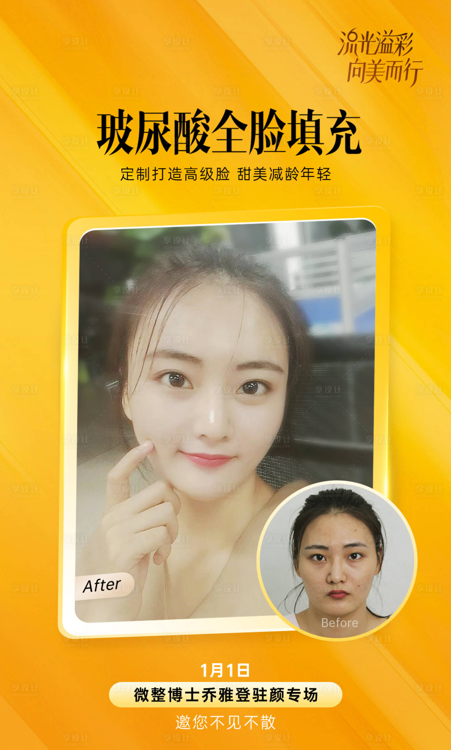 源文件下载【医美乔雅登案例图】编号：64840015616411642
