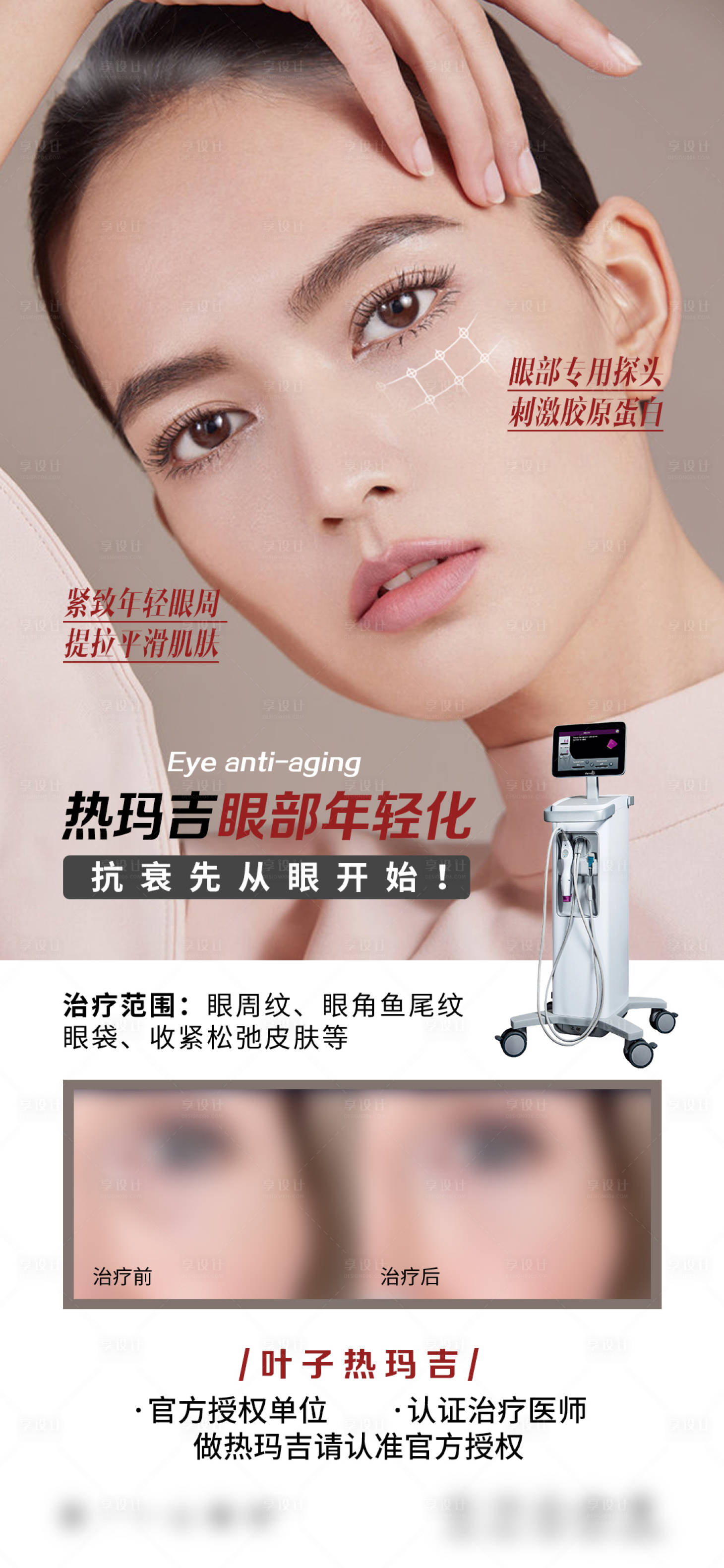 源文件下載【享設(shè)計】搜索編號：88810015684896907【醫(yī)美眼部熱瑪吉抗衰海報】