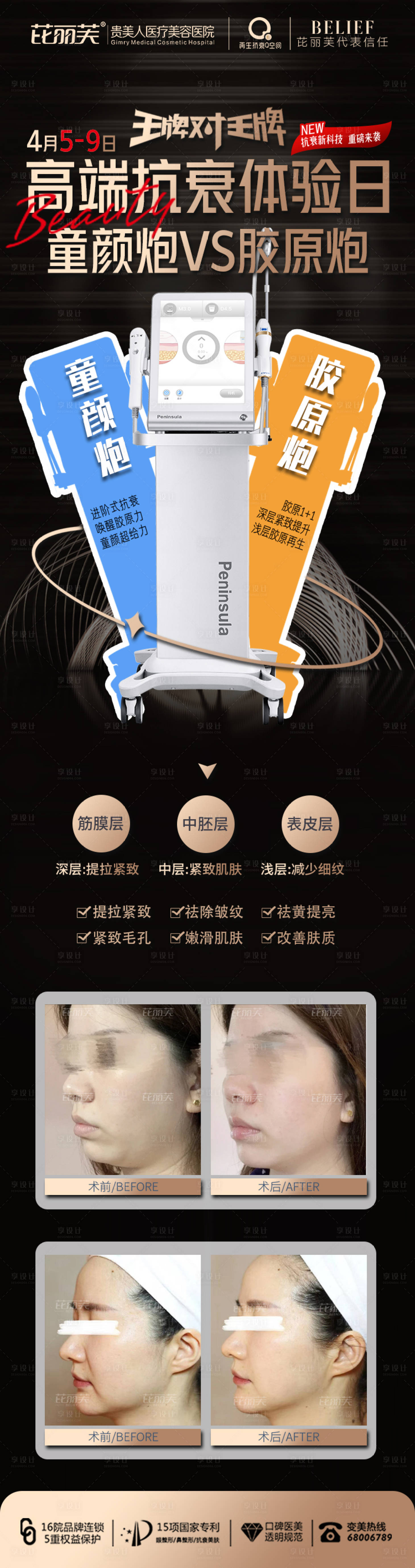 源文件下载【医美超声炮抗衰】编号：78040015950745799