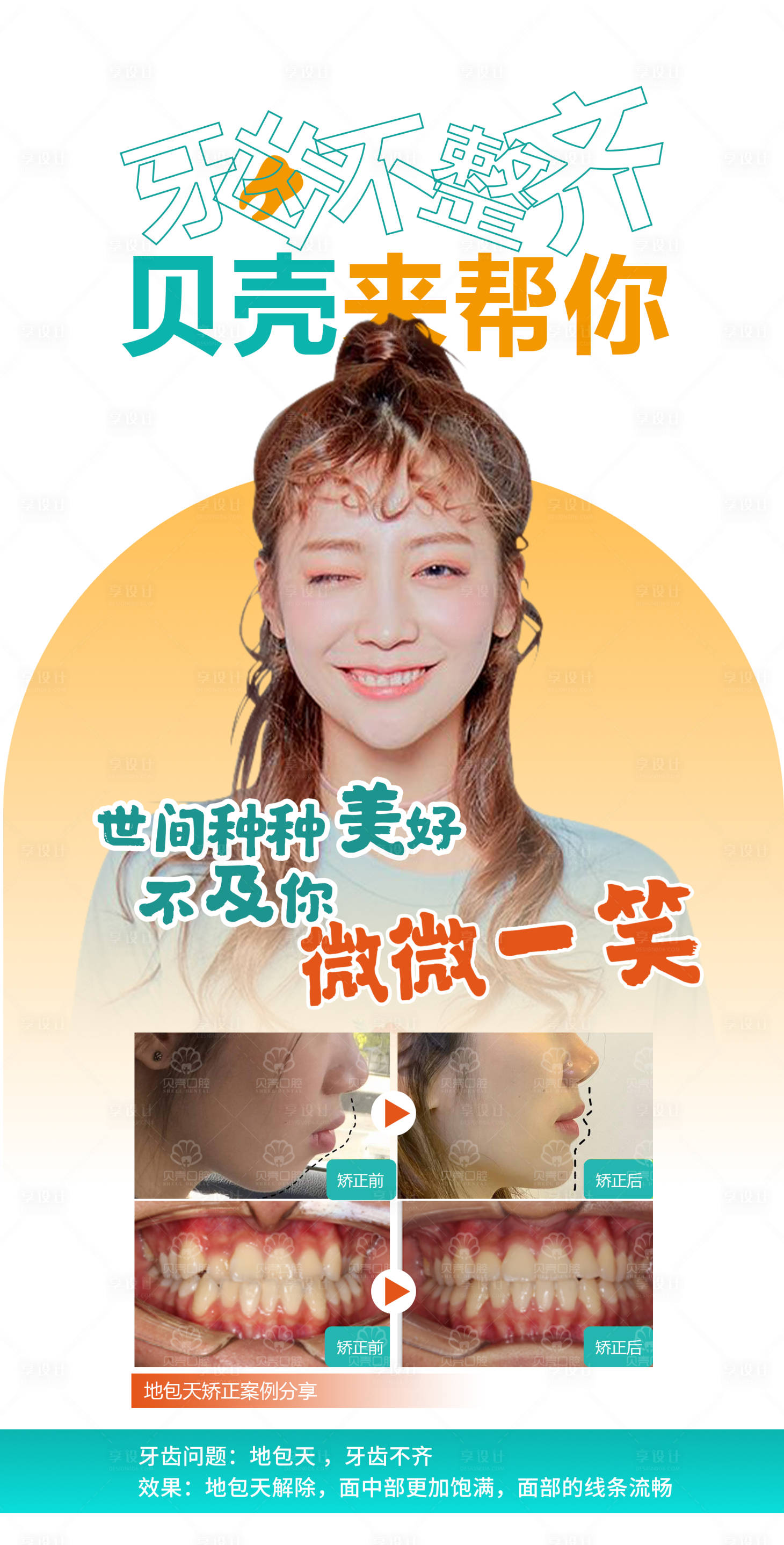源文件下載【享設計】搜索編號：27250015954046636【牙齒矯正案例海報】