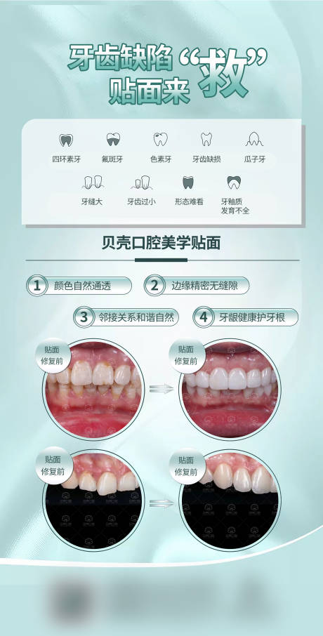 源文件下载【享设计】搜索编号：35510015954285691【牙齿贴面案例海报】