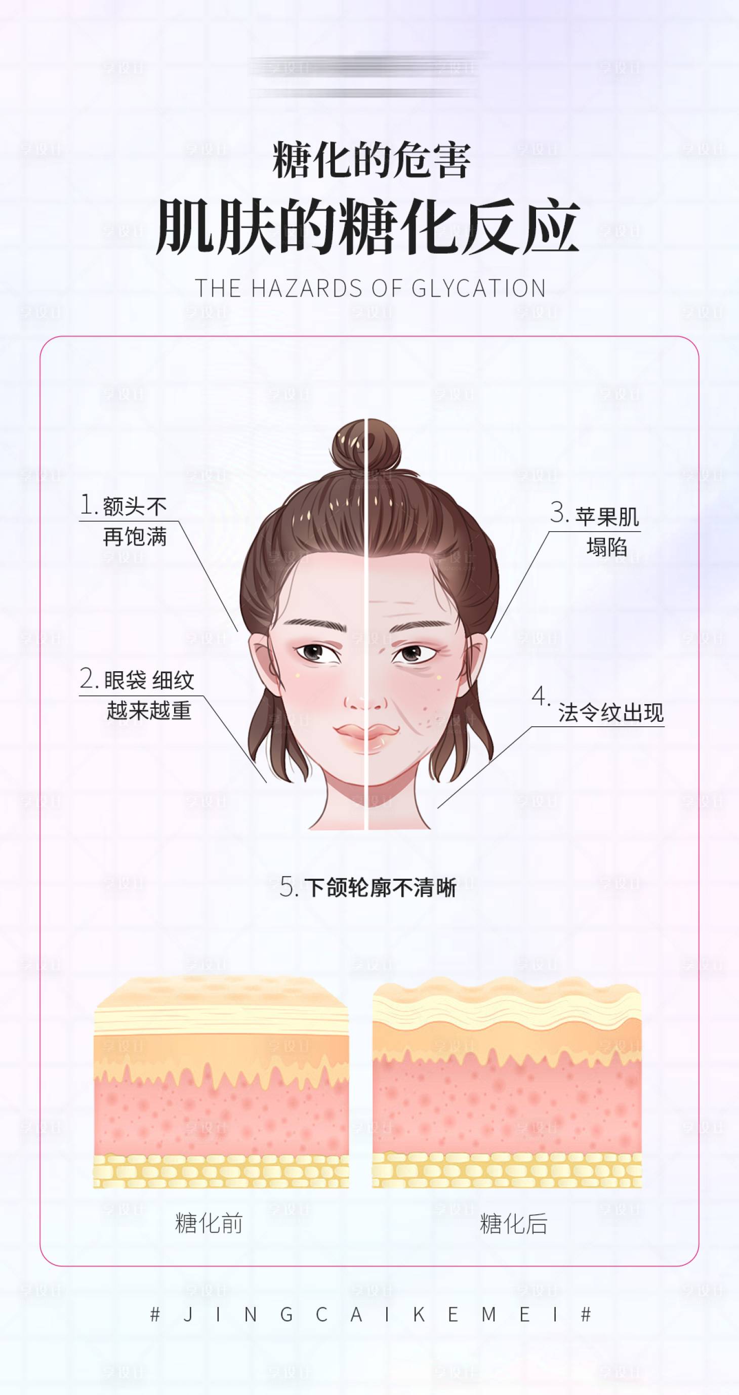 源文件下載【享設(shè)計(jì)】搜索編號(hào)：13200016269082752【肌膚糖化的表現(xiàn) 】