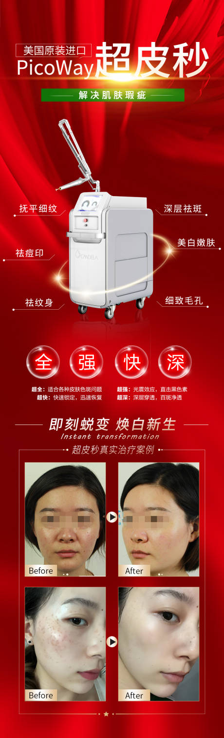 源文件下载【医美超皮秒红色海报】编号：75420016217159632