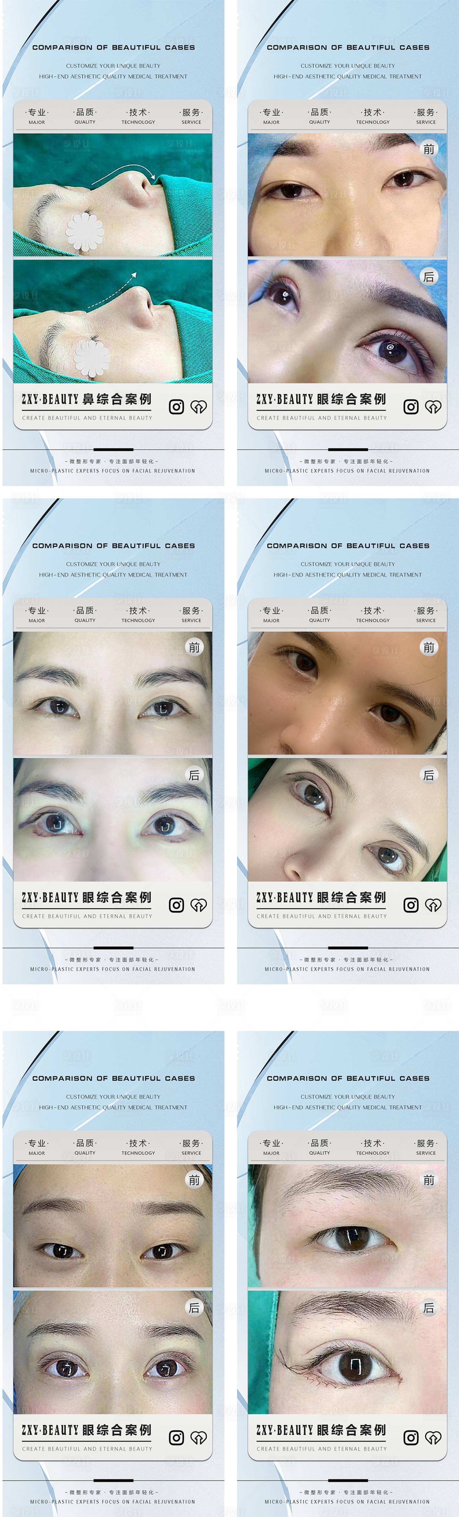 源文件下載【享設計】搜索編號：51710015897769114【醫美整形案例集手術海報】