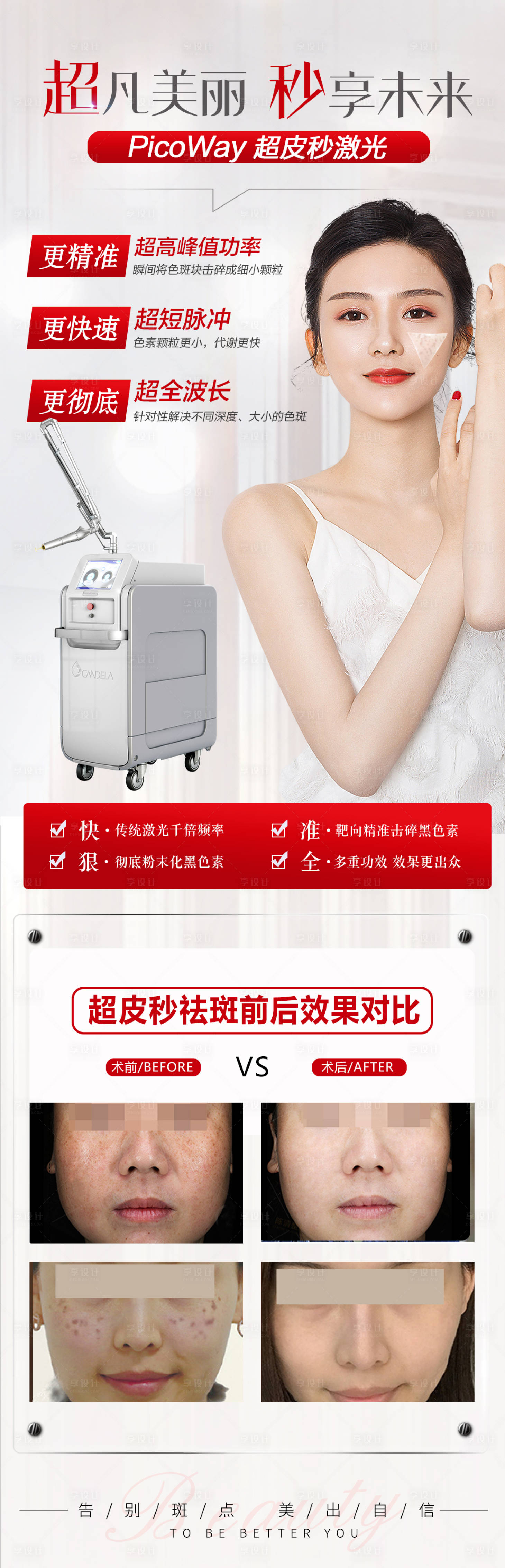 源文件下载【享设计】搜索编号：80550015882023438【超皮秒盆友圈海报】