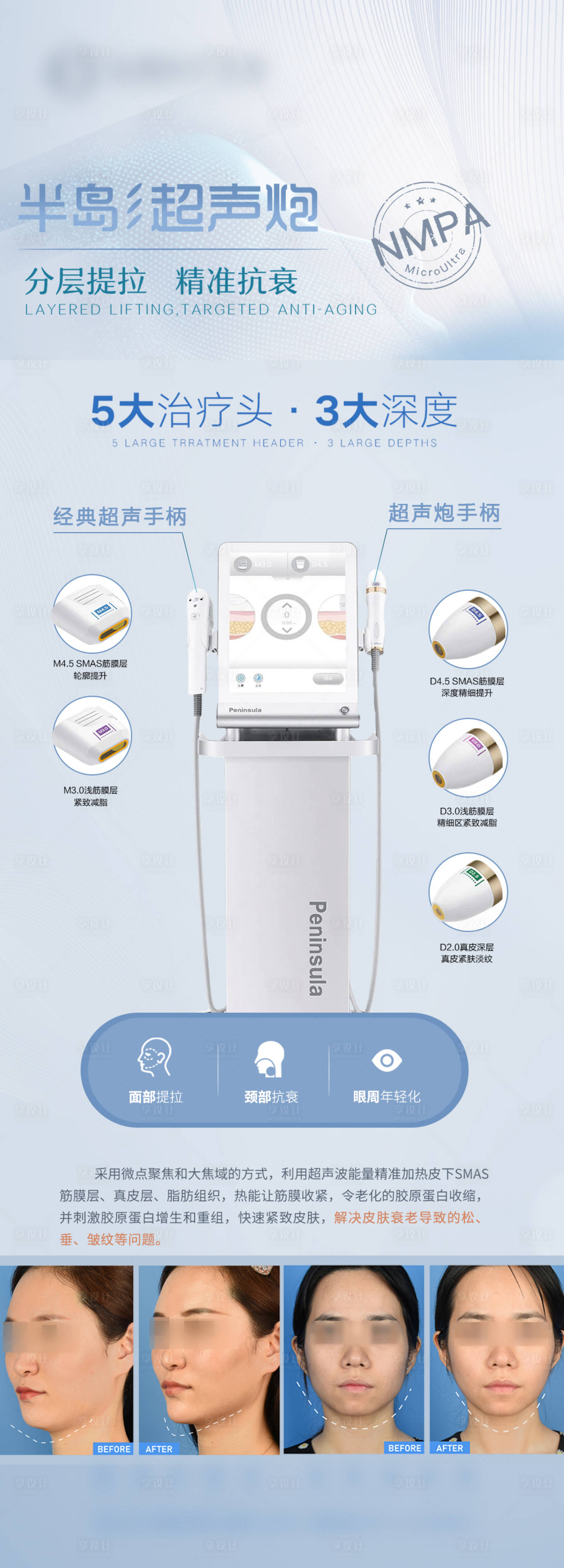 源文件下載【享設(shè)計】搜索編號：70130016018805792【半島超聲炮宣傳海報】