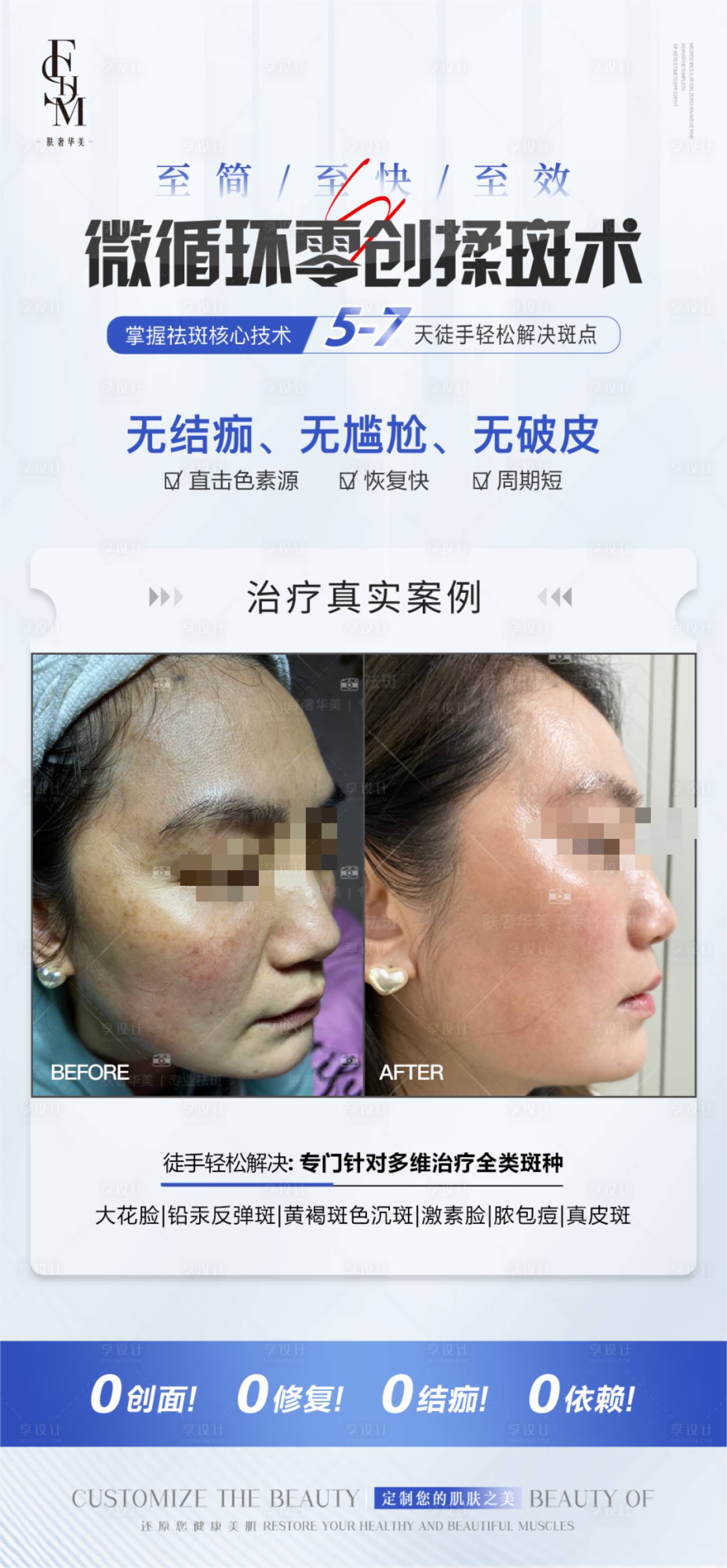 源文件下載【享設(shè)計】搜索編號：97840016022678324【醫(yī)美祛斑案例對比框海報】