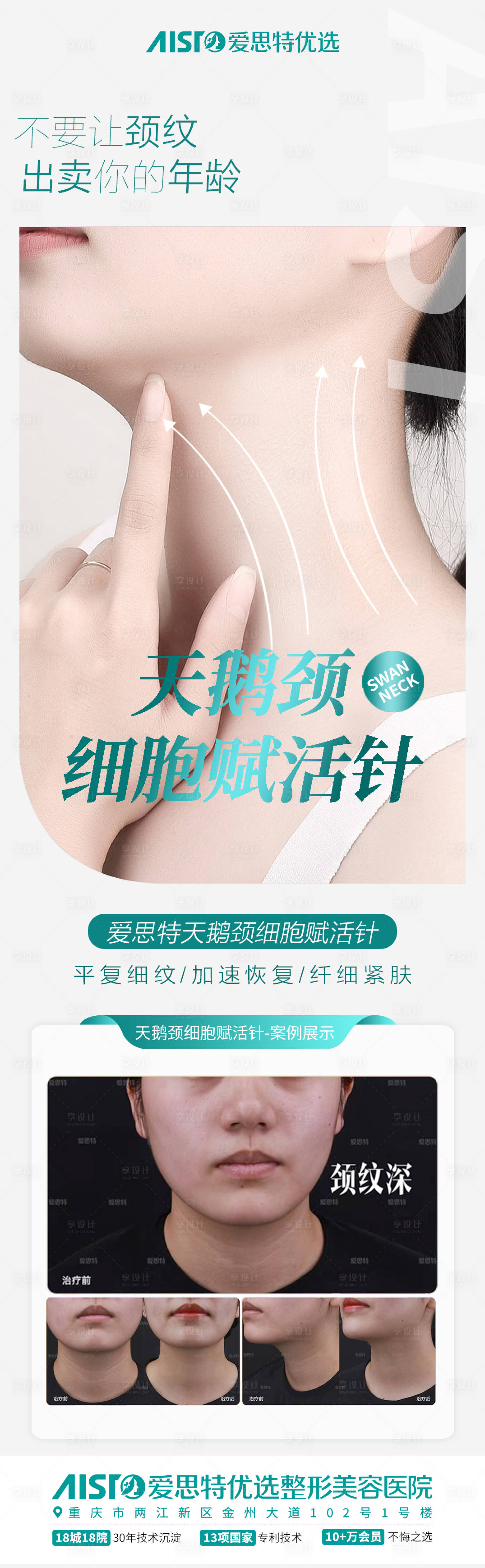 源文件下載【享設計】搜索編號：10500015793874720【醫美天鵝頸案例對比海報長圖】
