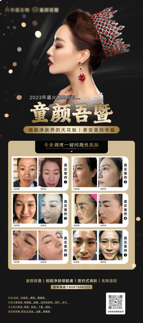 源文件下载【轻医美祛斑祛痘美白亮肤活动海报展架】编号：33560016016777704