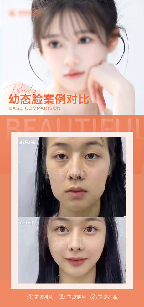 源文件下载【医美幼态脸案例对比】编号：14820016278584519