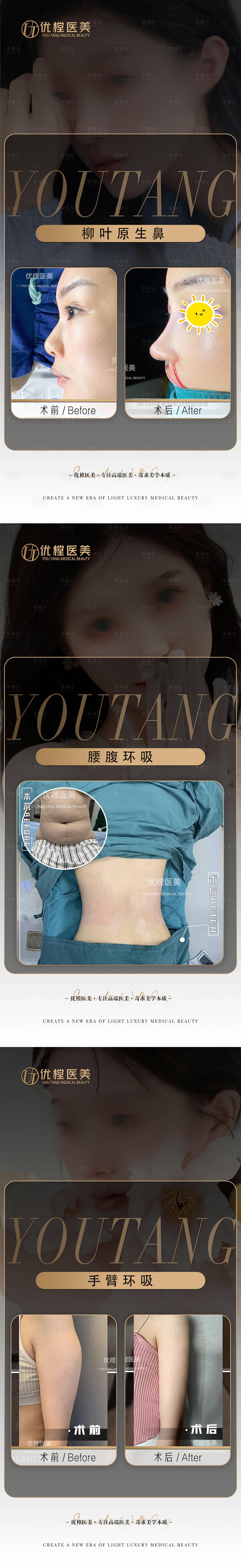 源文件下载【享设计】搜索编号：93520015902953179【医美案例海报】