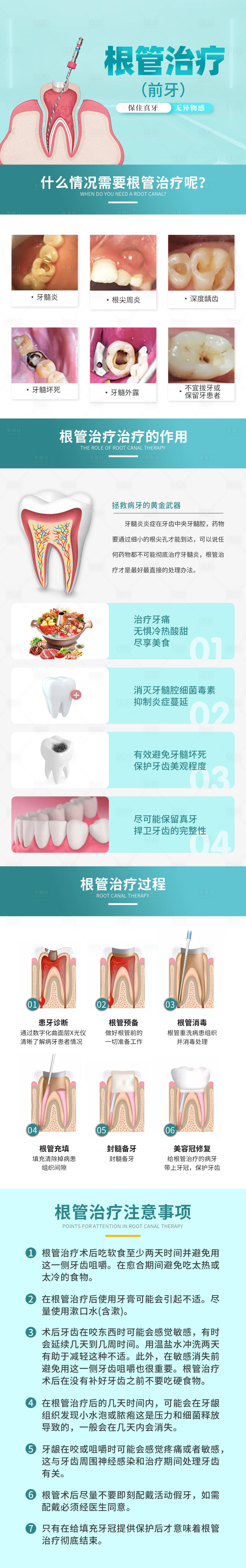 源文件下載【享設計】搜索編號：70930016398203484【根管治療詳情頁】