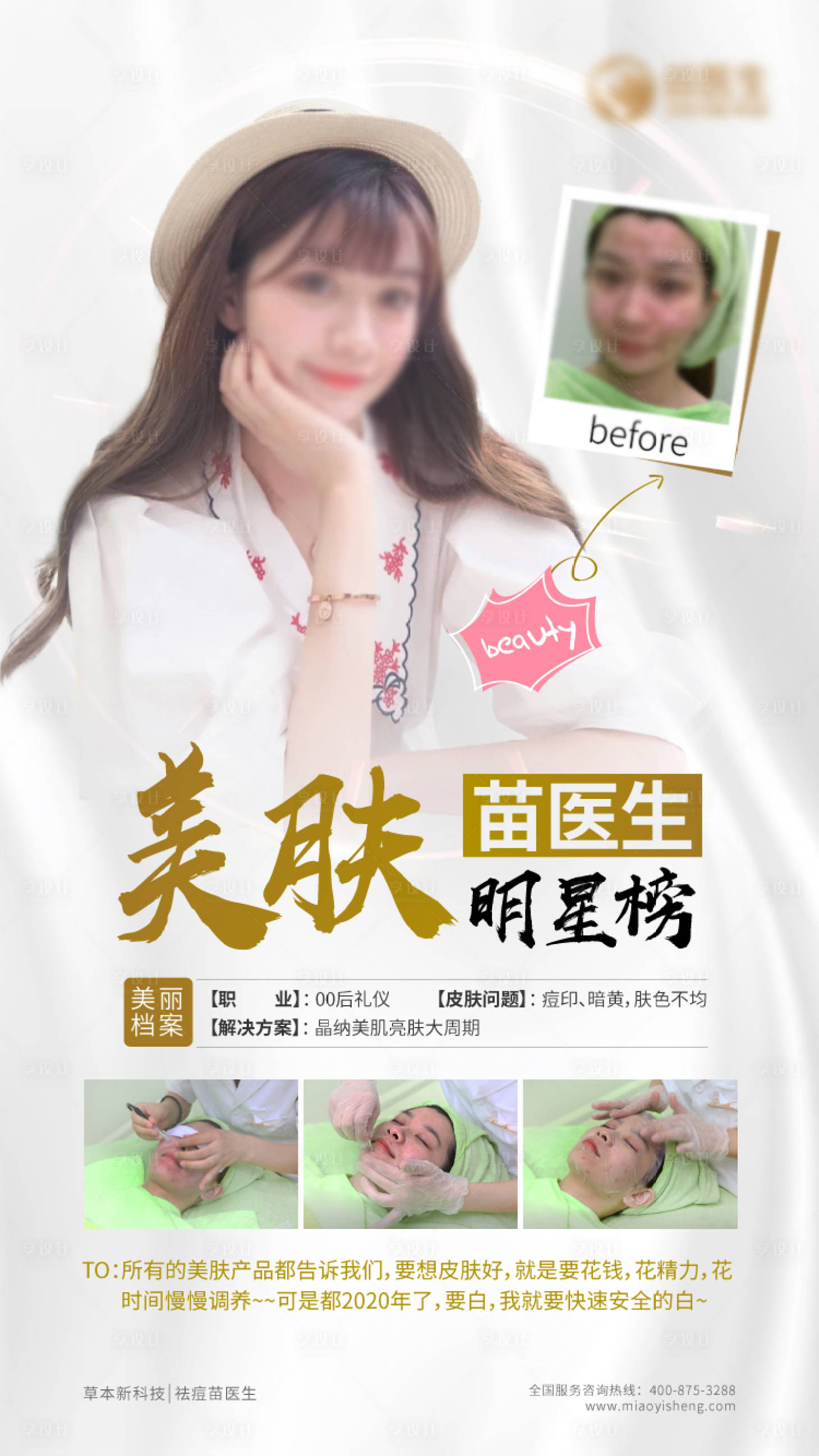 源文件下载【享设计】搜索编号：35610016134822783【美女祛痘对比明星榜朋友圈海报】