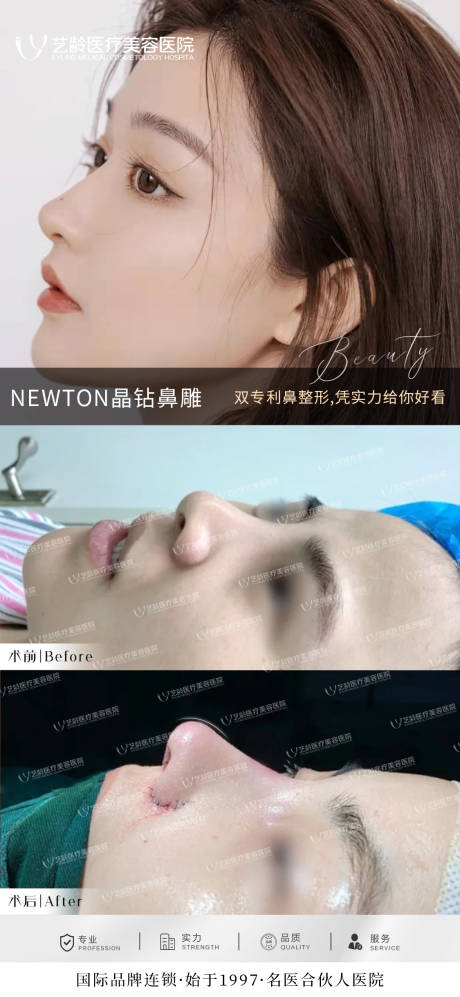 源文件下载【鼻综合案例】编号：33930016054494577