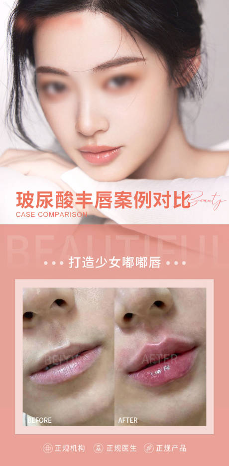 源文件下载【享设计】搜索编号：89500015883792558【医美丰唇海报】