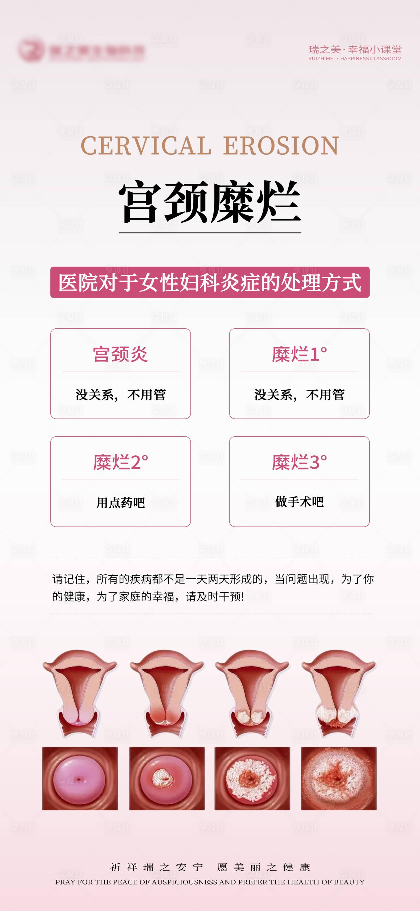 源文件下载【私密宫颈养护】编号：78660015881815500