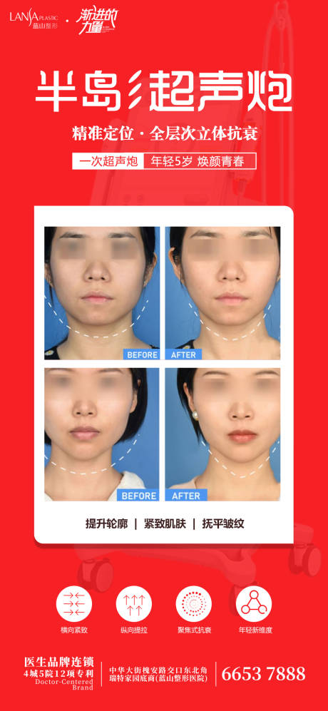 源文件下載【享設計】搜索編號：88440016020299200【超聲炮海報】