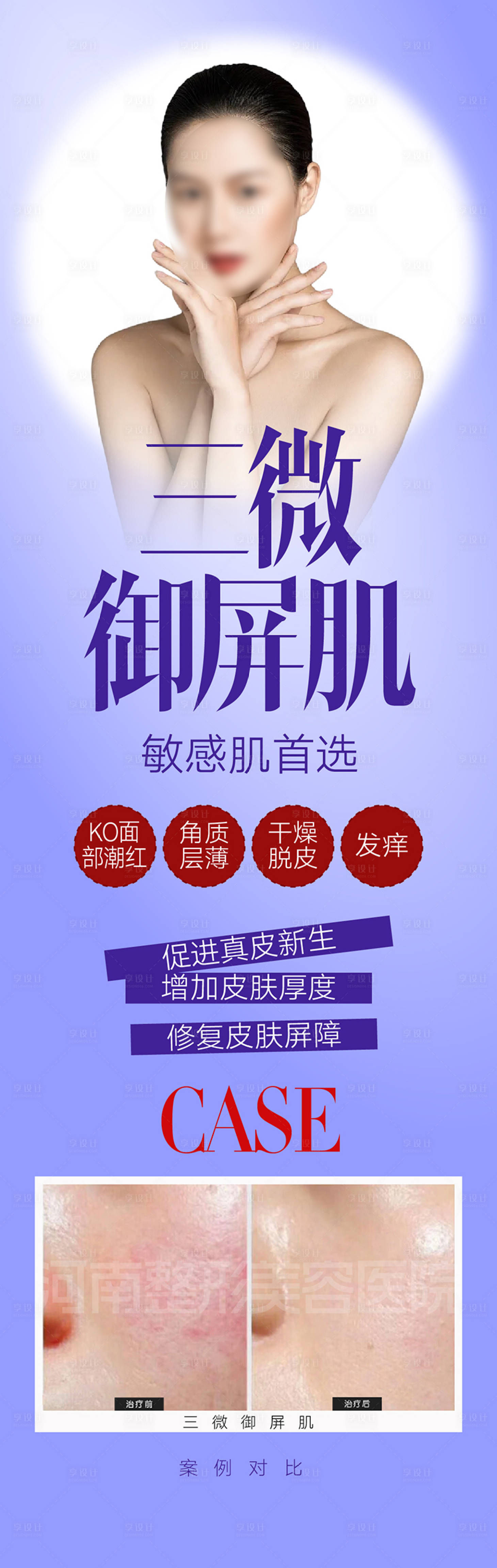 源文件下载【整形美白医疗美容海报广告设计】编号：53820015877666107