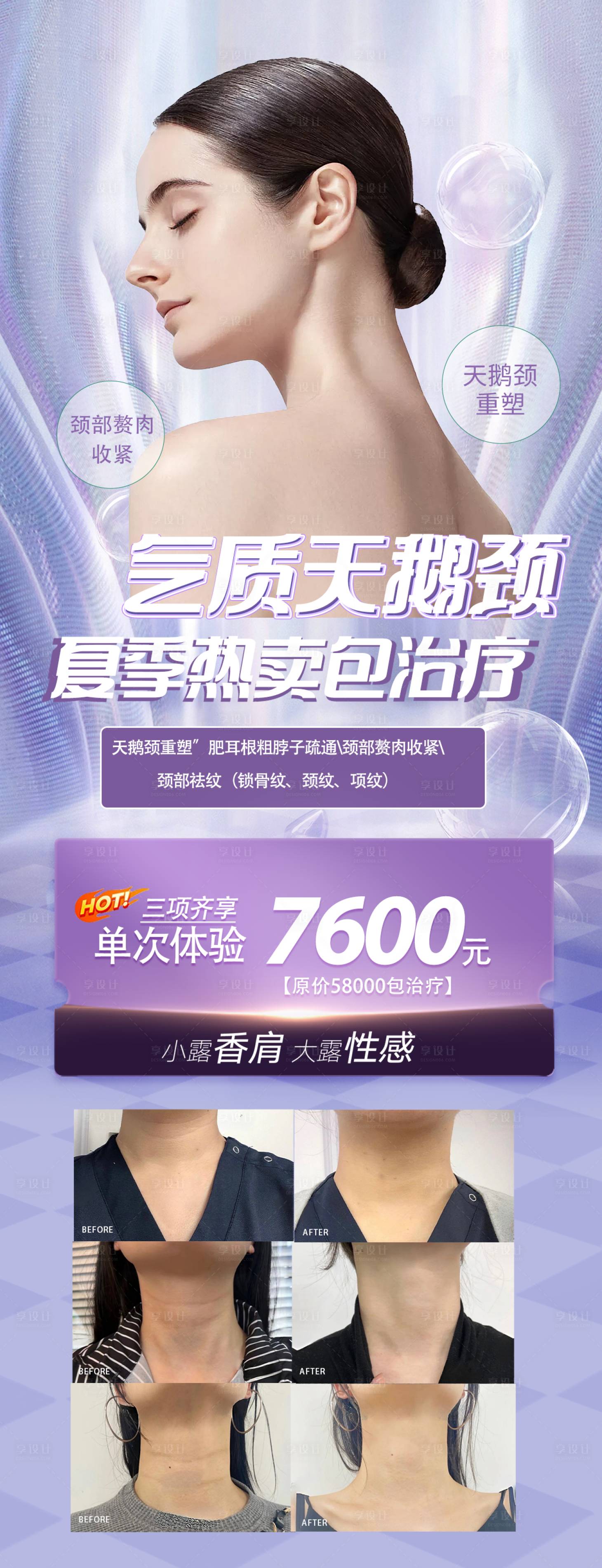 源文件下载【紫色瘦身医美海报】编号：95420016195114484