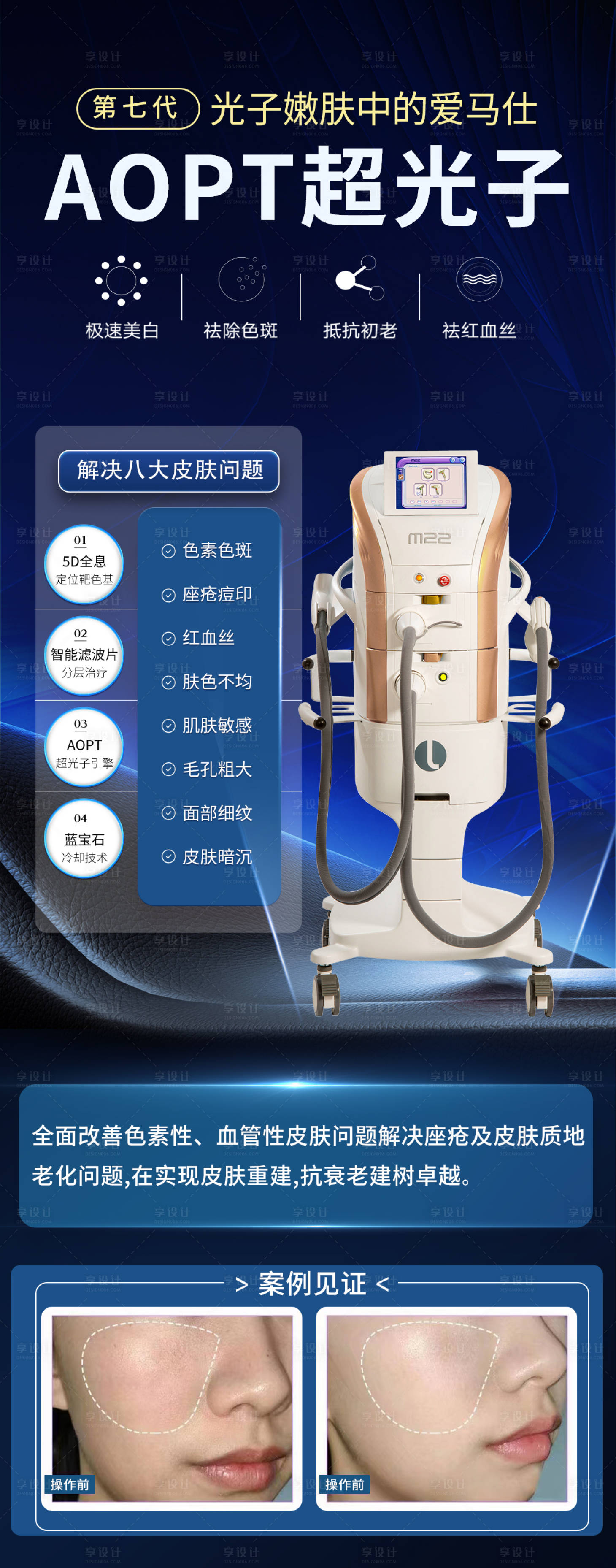 源文件下载【享设计】搜索编号：92710015809788047【医美超光子海报】