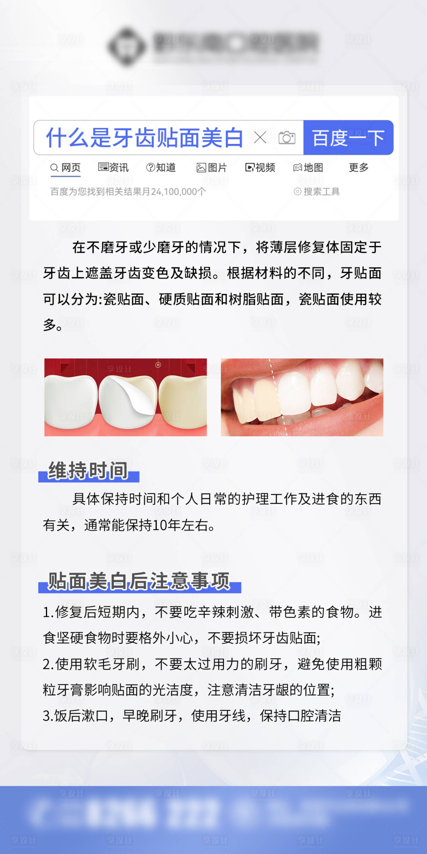 源文件下載【享設計】搜索編號：97920016285773905【牙齒美白科普海報】