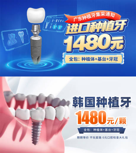 源文件下载【进口种植牙banner头图】编号：66740016398101736
