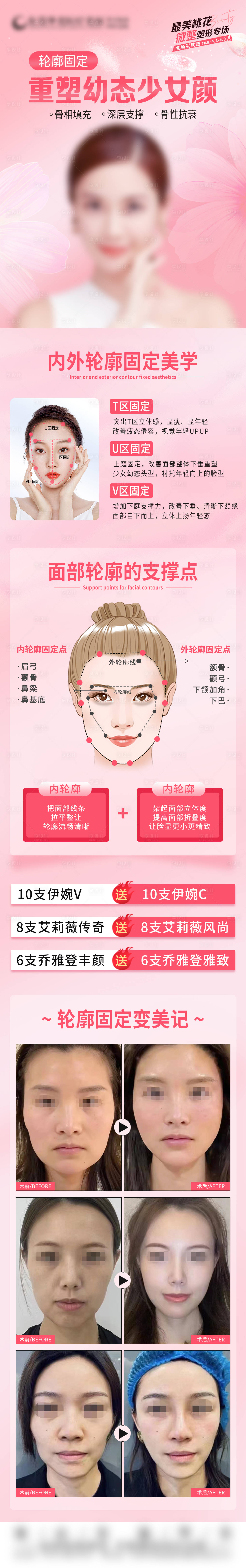 源文件下載【享設(shè)計(jì)】搜索編號(hào)：26500016078029376【輪廓固定科普 】