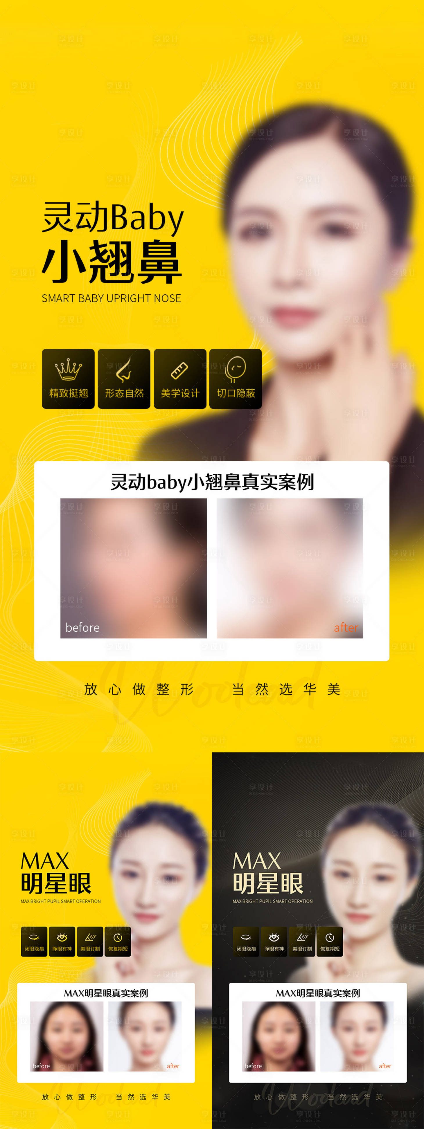 源文件下载【医美案例海报】编号：48210015817058004