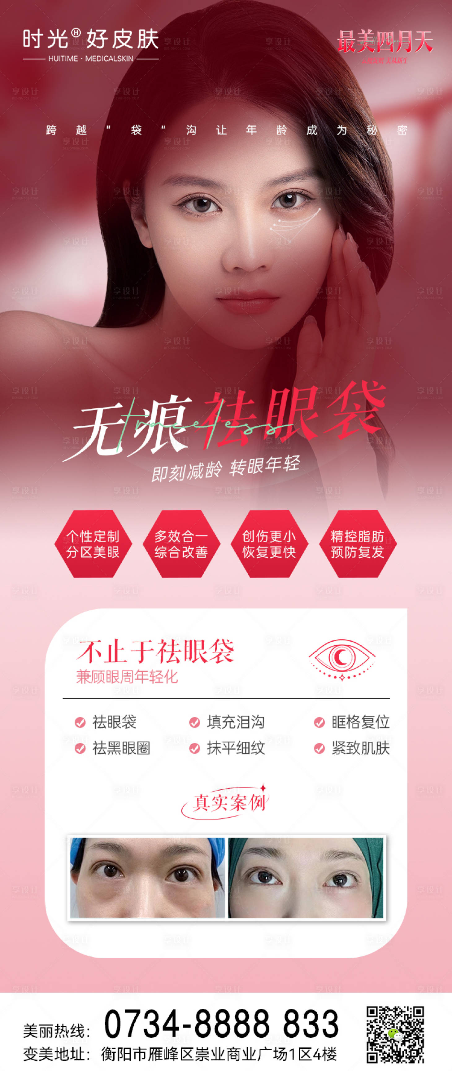 源文件下載【享設計】搜索編號：87340015968253184【去眼袋長圖】