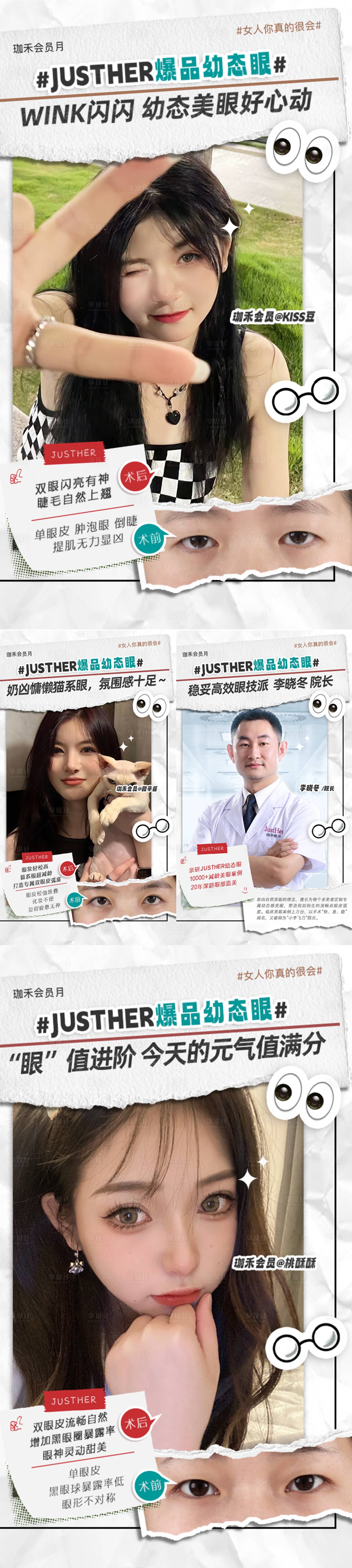 源文件下载【双眼皮案例对比海报】编号：15080016274369904