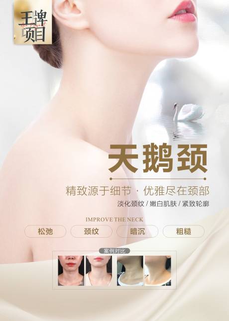 源文件下载【医美天鹅颈海报】编号：47130015907629236