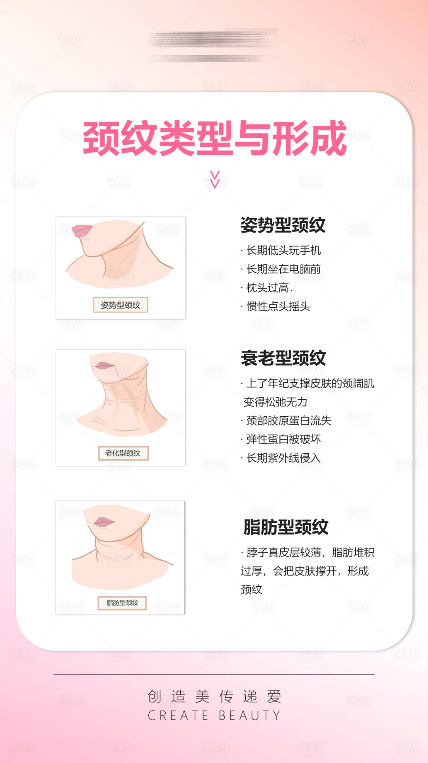 源文件下载【颈纹类型 】编号：31890016062823261