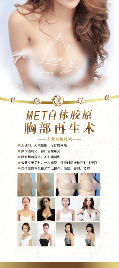 源文件下載【享設(shè)計】搜索編號：42930016060974840【胸部再生術(shù)】