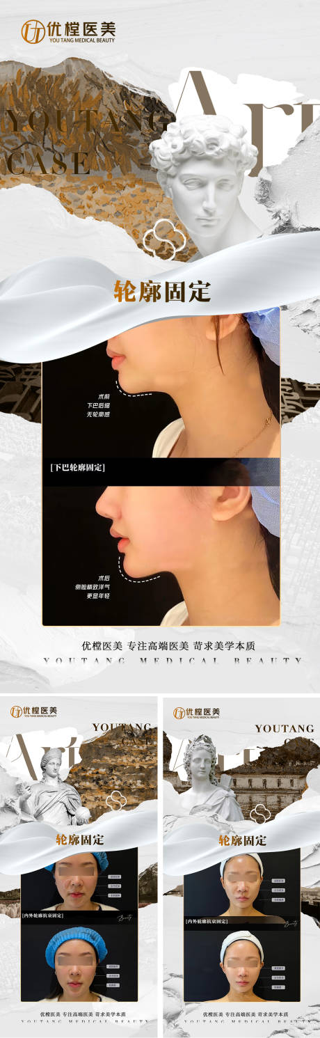 源文件下載【醫美案例海報】編號：48750015801446582