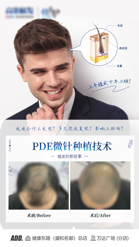 源文件下载【享设计】搜索编号：59200016060423354【植发案例海报】