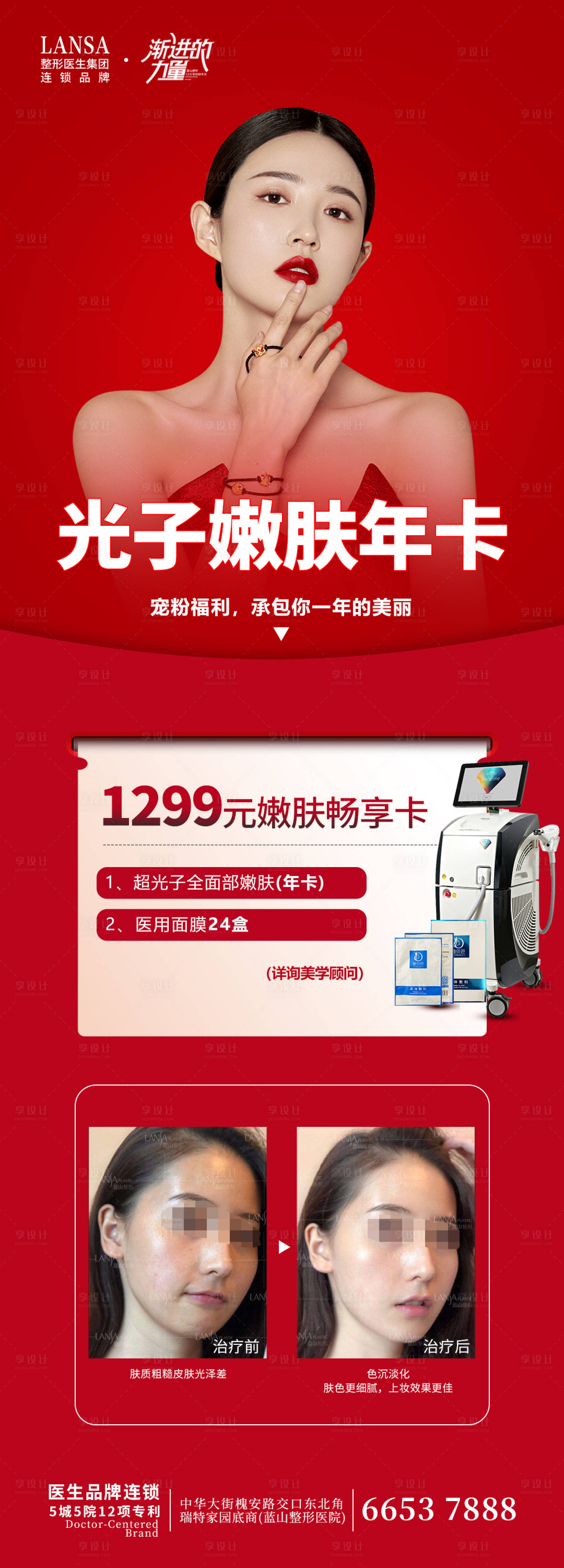 源文件下載【光子嫩膚】編號：46920016020123667